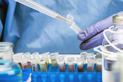 a gloved hand fills a test tube over a tray of tubes to track covid rates through wastewater testing